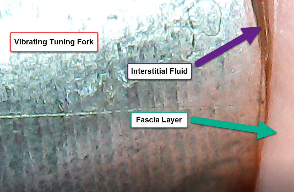 Vibrating Tuning Forks diffuse Interstitial Fluid through Fascia Layers: Part One