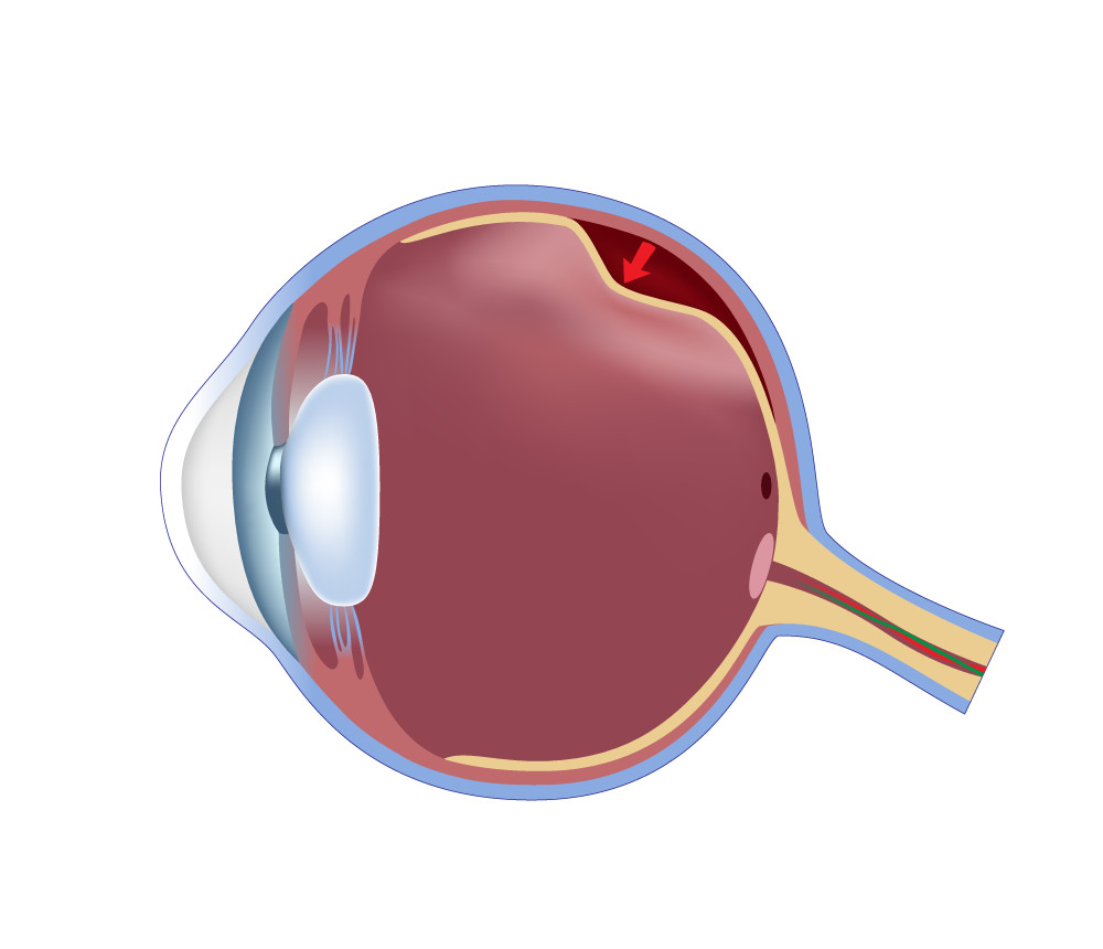 EyePathology1